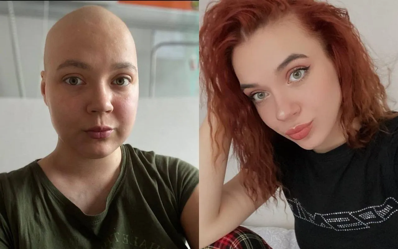 лечение лимфосмы в Польше